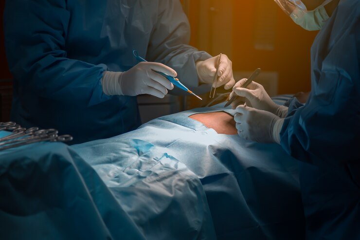 Soft tissue tumor 