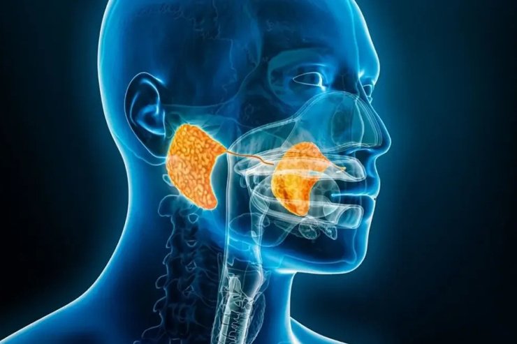 Salivary Gland Tumor